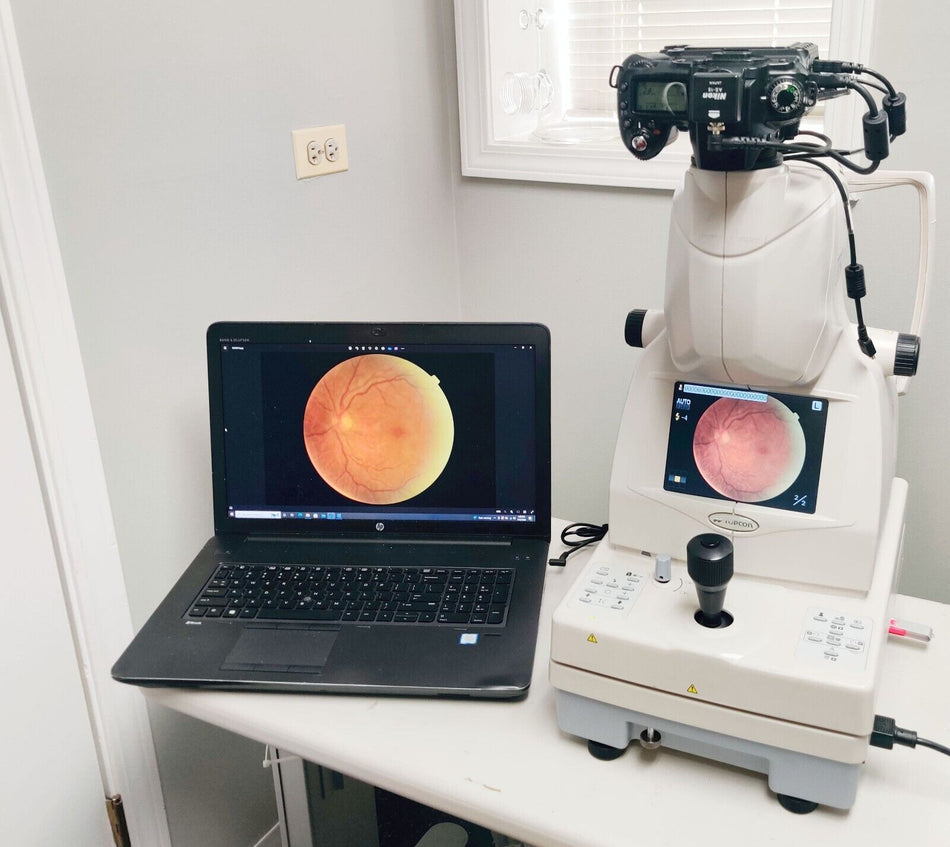 Topcon TRC NW8 Non-mydriatic Retinal Camera w Nikon D90 Camera & Table. Working