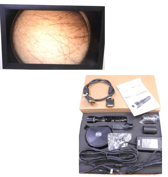 GlobalMed TotalExam 1080 HD Digital Camera USB for Microscope & Telemedicene