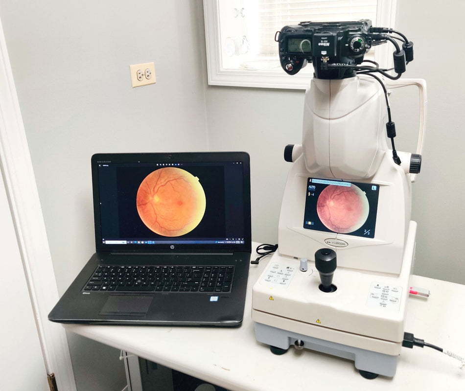 Topcon TRC NW8 Non-mydriatic Fundus Retinal Camera w Nikon D90. Tested