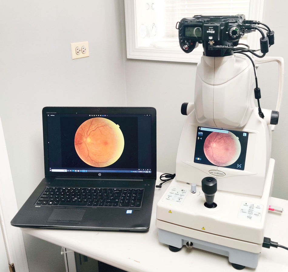 Topcon TRC NW8 Non-mydriatic Fundus Retinal Camera w Nikon D90. Tested