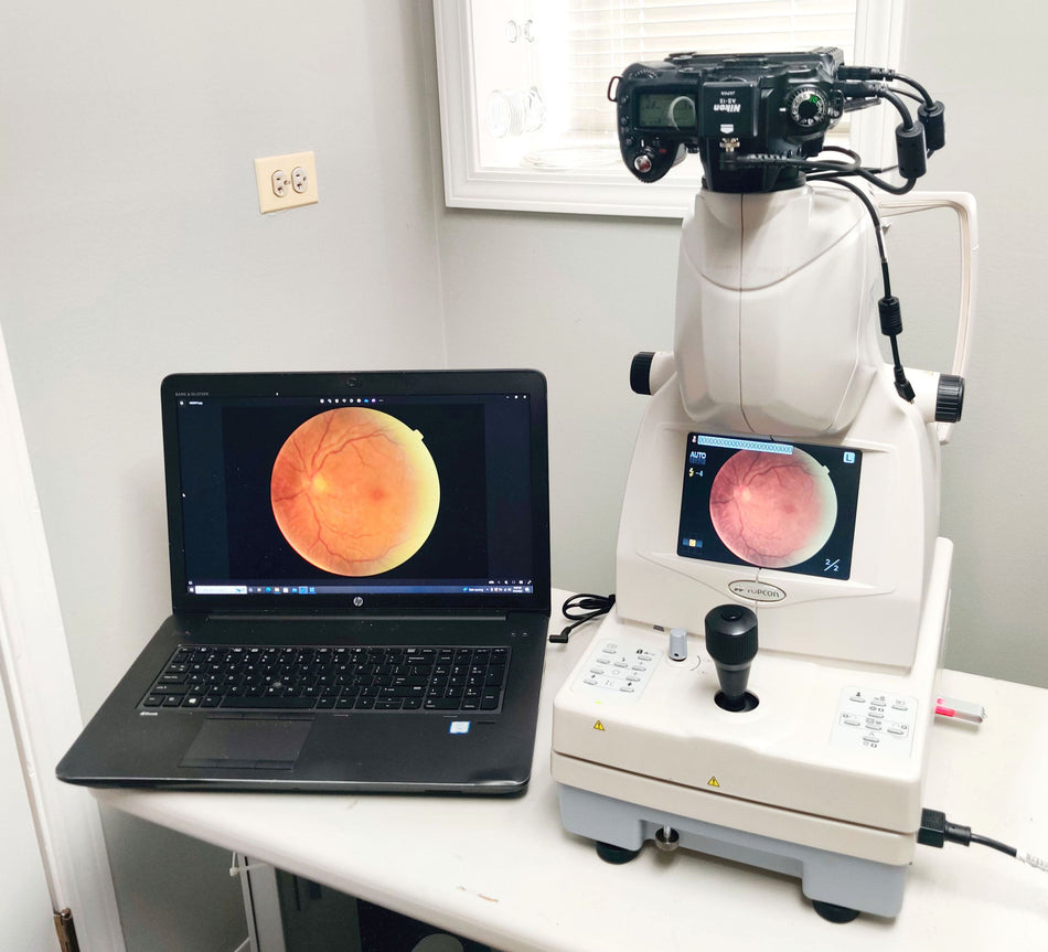 Topcon TRC NW8 Non-mydriatic Fundus Retinal Camera w Nikon D90. Tested