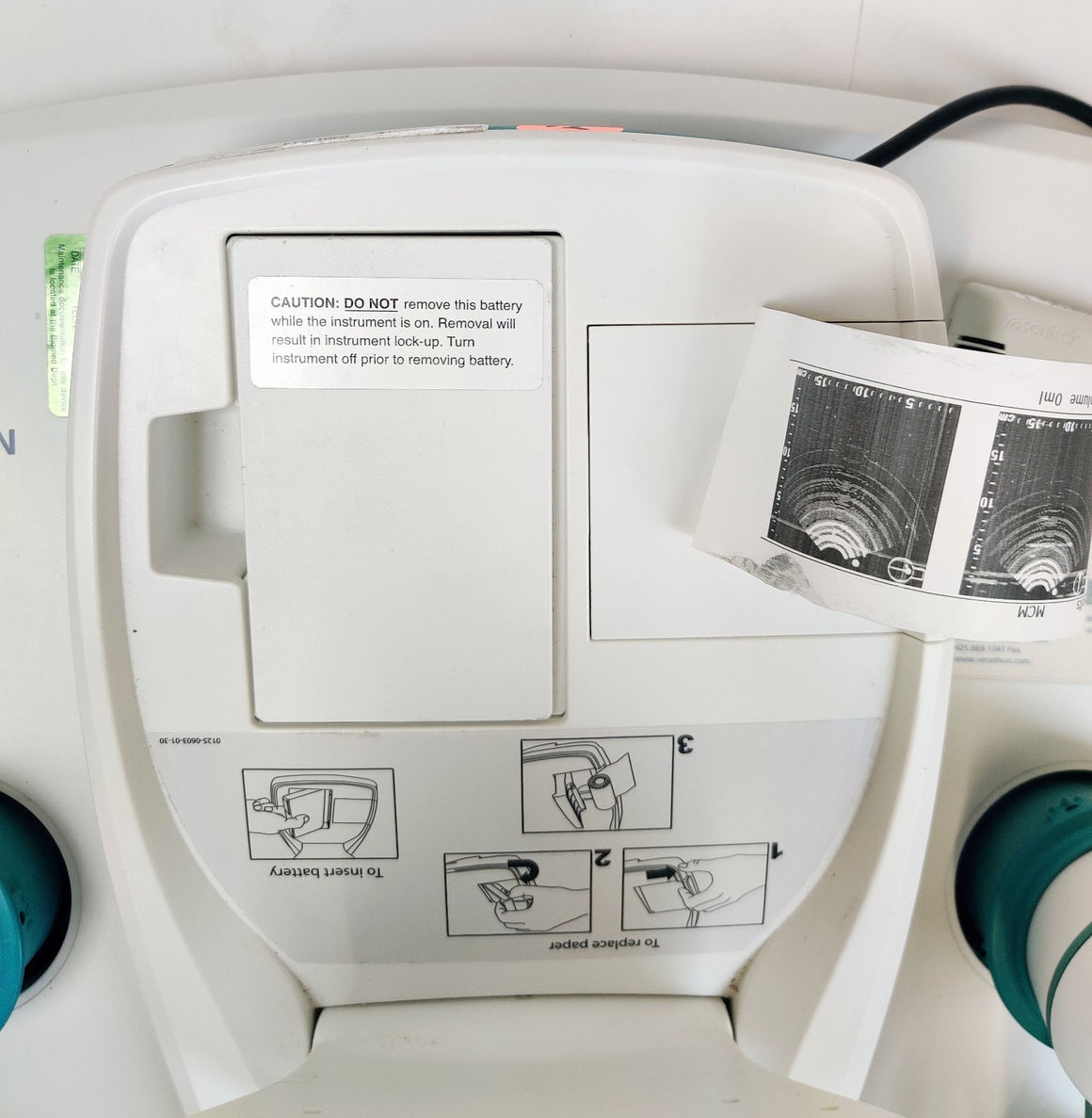 Verathon BVI 9400 Bladder Scanner w 0570-0351 Probe, Charger, Battery, Stand - 