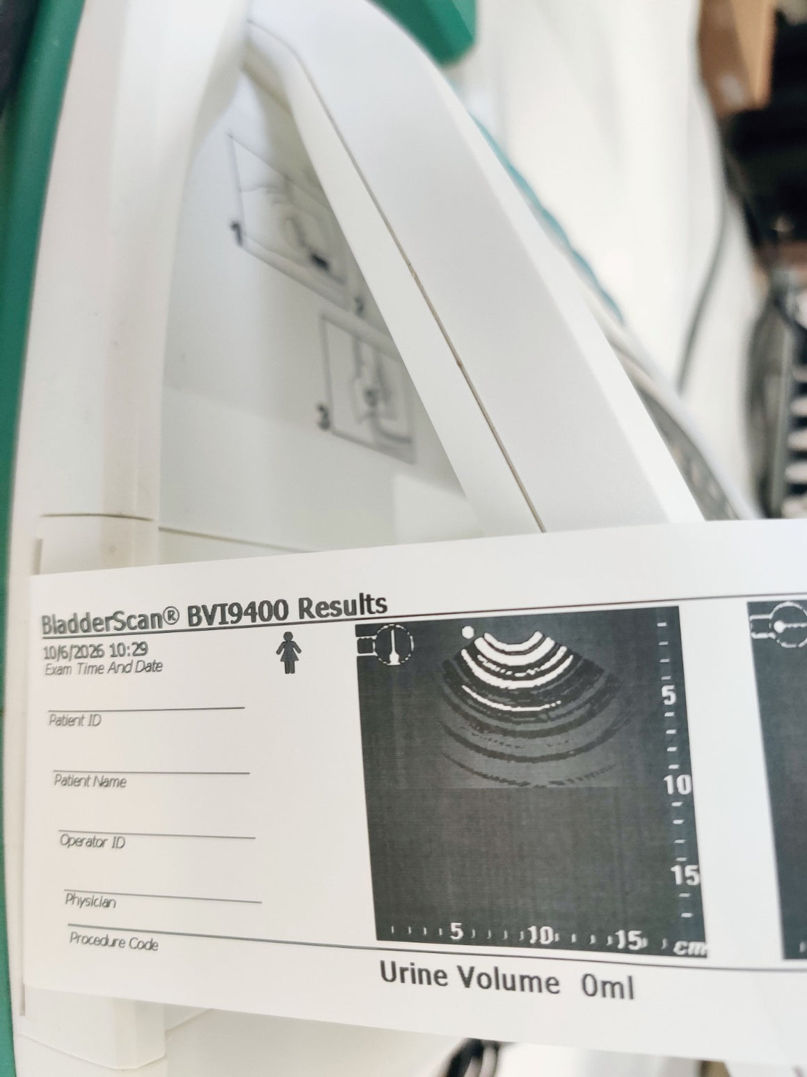 Verathon BVI 9400 Bladder Scanner 0570-0190 w 0570-0351 Probe and Power Supply - 