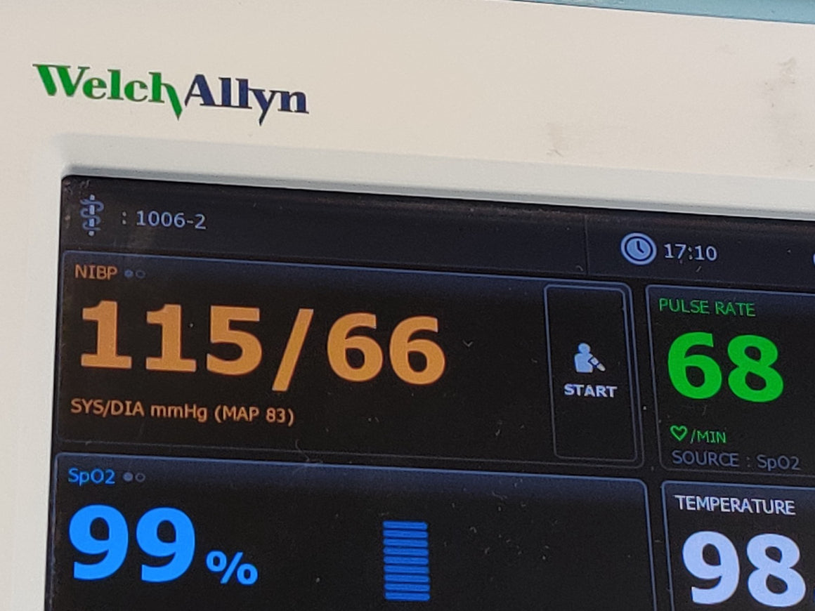 Vital Signs Monitor Welch Allyn 65MTXX Connex 6000