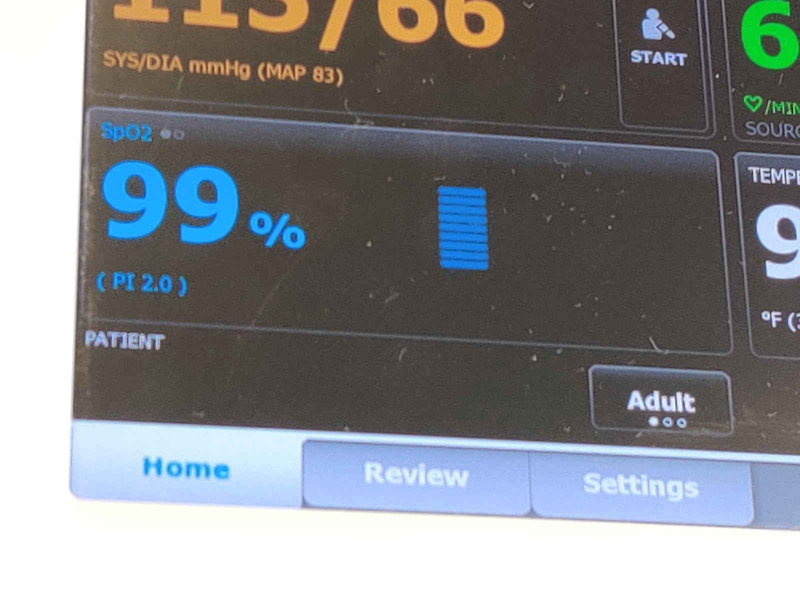 Vital Signs Monitor Welch Allyn 65MTXX Connex 6000